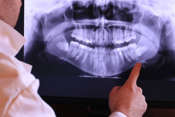 Best Urgent Dental Care  in Harvey, ND