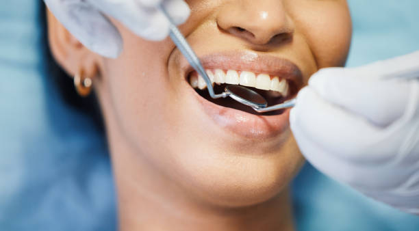 Best Affordable Emergency Dental Care  in Harvey, ND