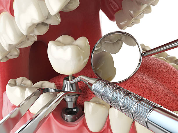 Best Emergency Dentist Near Me  in Harvey, ND